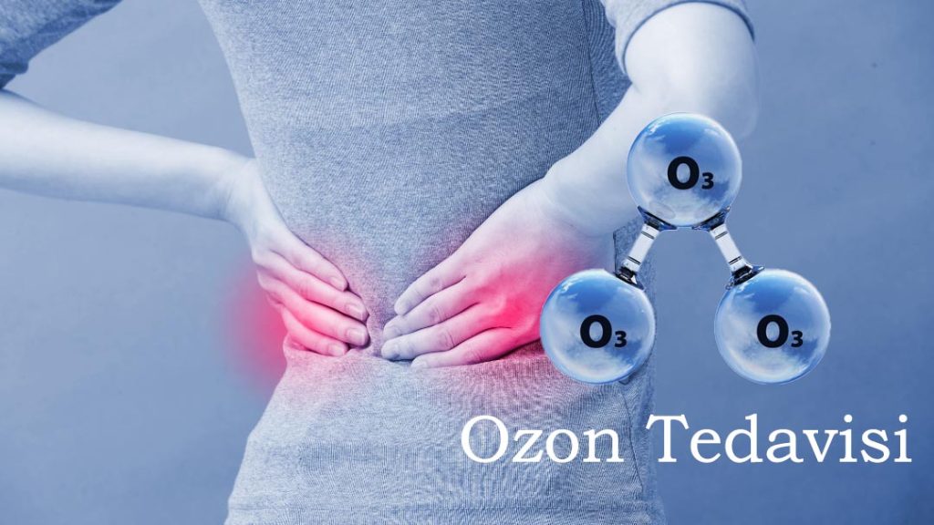 Ozon tedavisi